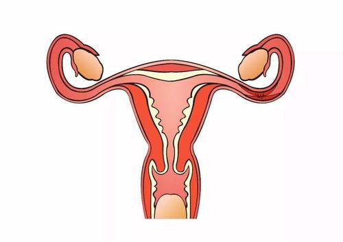 输卵管堵塞怎么办才能正确诊断呢,输卵管堵塞手术费用大概要多少