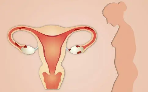 90后女性卵巢早衰不敢看体检报告，如何拯救？