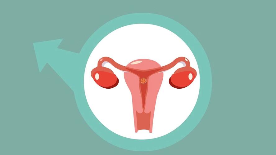 输卵管堵塞有哪些症状提前知道,输卵管堵塞能治愈吗
