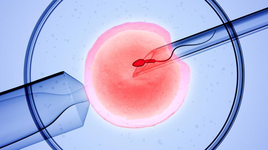 试管婴儿先做输卵管结扎的原因分析，可提高成功率别忽视