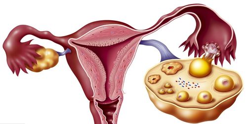 女性如何保养和调理卵巢，女性如何有效保养和调理卵巢功能