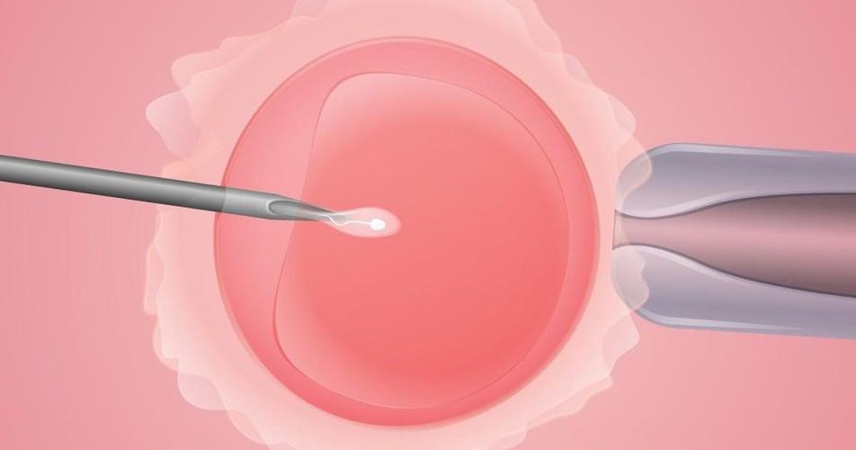卵巢囊肿的专科科室是什么，卵巢囊肿应该就诊的专科科室