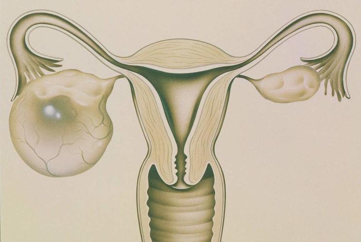 子宫卵巢的检查需要进行腹腔镜吗？