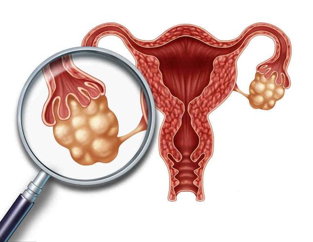 如何通过卵巢按摩来进行女性保养