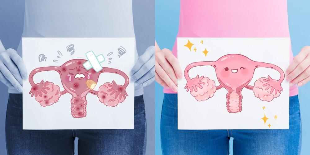 多卵巢多囊的改变会导致什么情况？